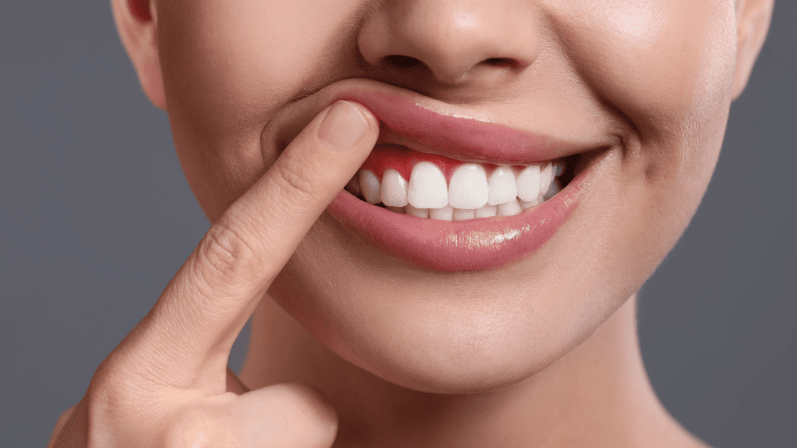 young woman showing inflamed gums on grey background