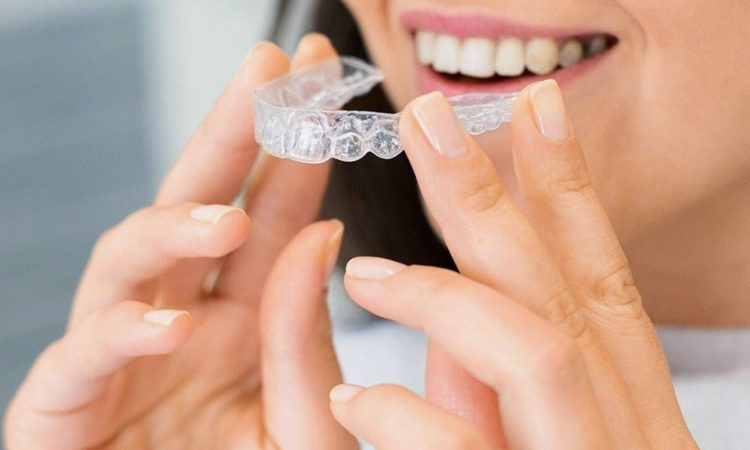 Clear aligners / invisible braces