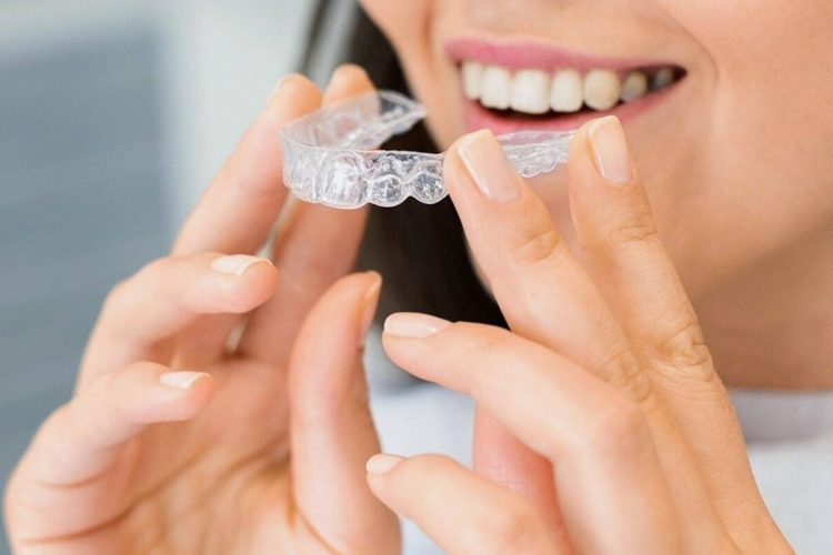 Clear aligners / invisible braces